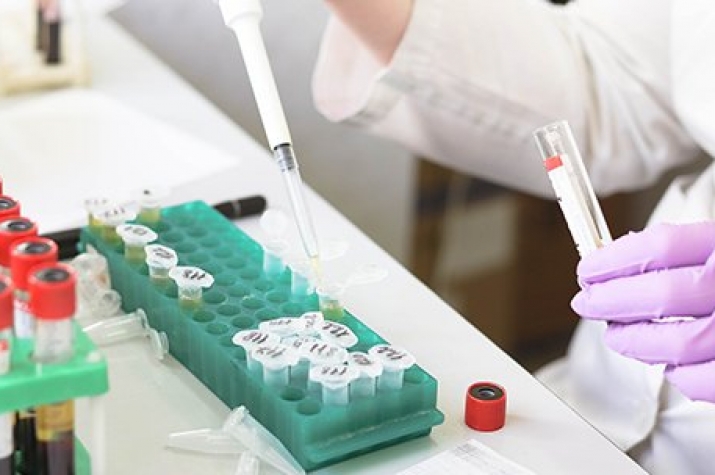 zsm-5分子筛的特性